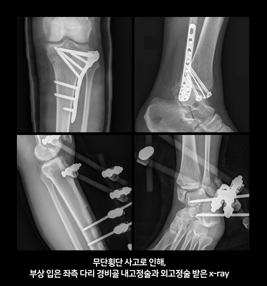 x-rayㄴㄴㄴ.png