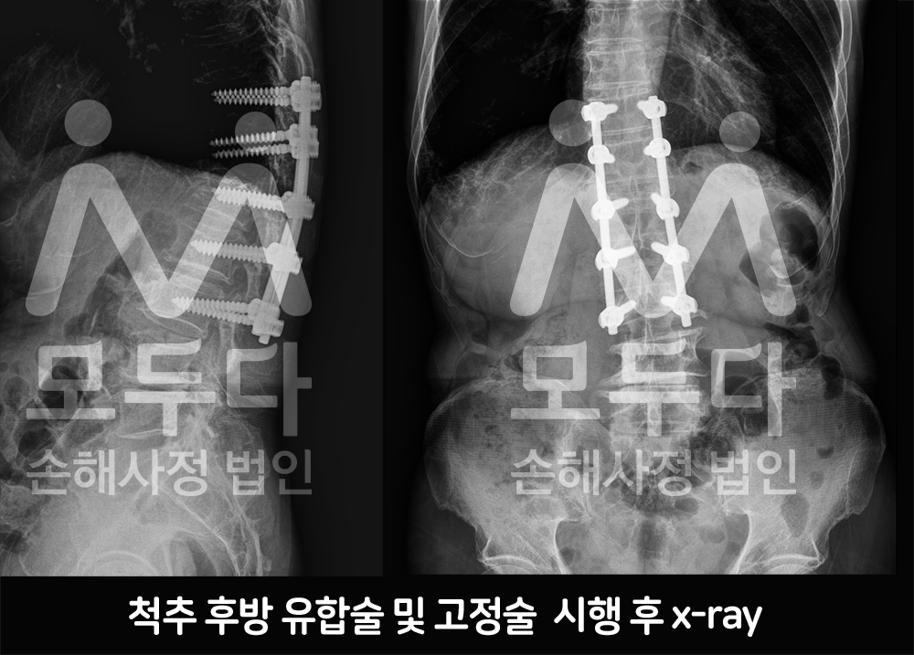 x-ray_홈피용.png