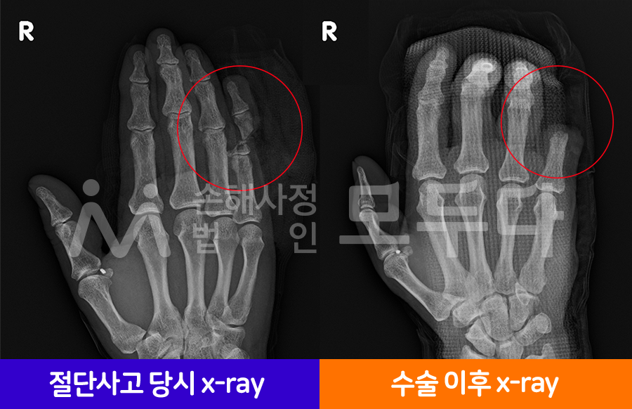 x-ray.png